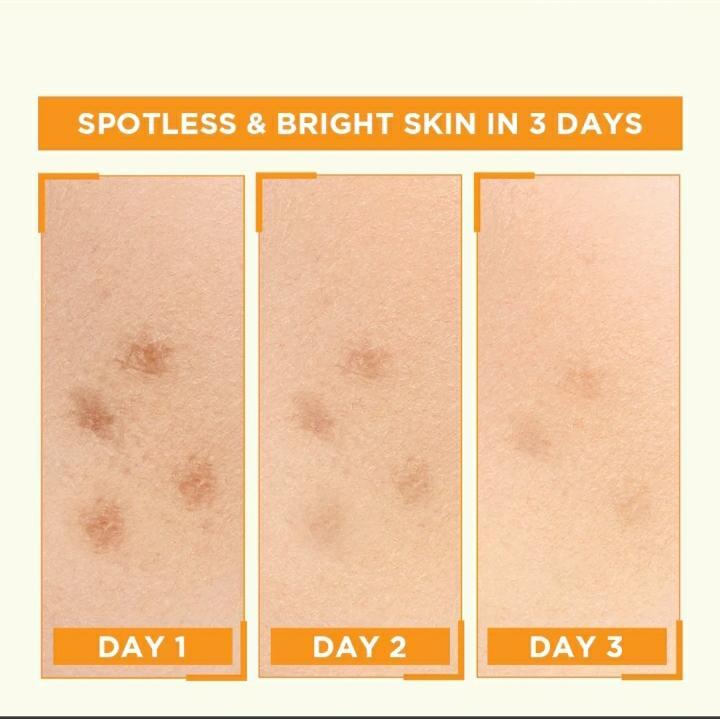 Skin Brightening Vitamin-C Serum - 30 ml