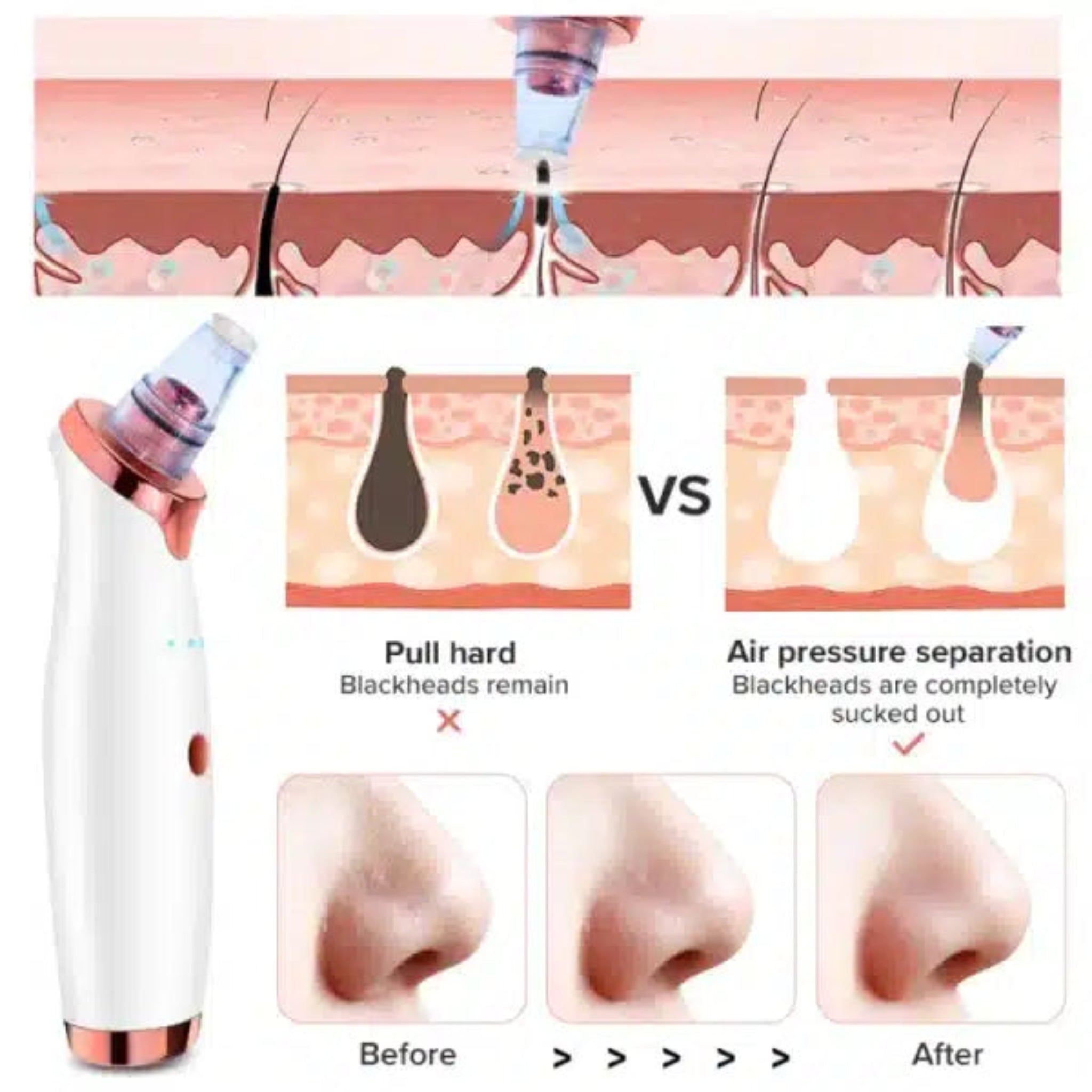 USB Rechargeable Blackhead Extractor Device